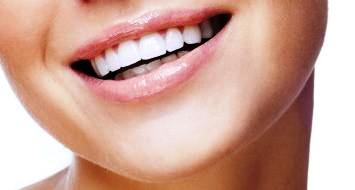 ODONTOLOGOS - DIENTES - SORRISA