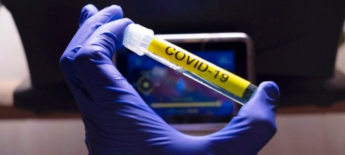 Es vital que la respuesta de los países de América al coronavirus incluya el tratamiento de las enfermedades no transmisibles