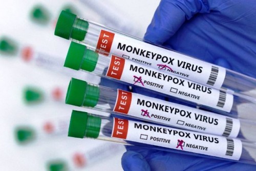 Cuáles son los síntomas y formas de contagio de la Viruela del Mono