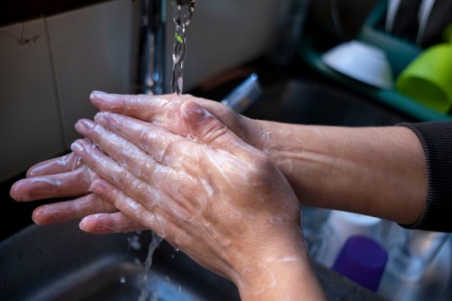 Agua: en algunas zonas, cloruro, sodio y conductividad exceden los máximos aceptados