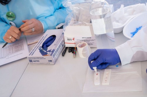 OMS: La hepatitis podría ser más letal que la malaria, la tuberculosis y el sida en 2040